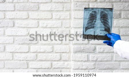The doctor examines the chest in the picture. X-ray of the lungs in the hands of a doctor against the background of a white brick wall. Pneumonia of the lungs. the diagnosis is made by the patient