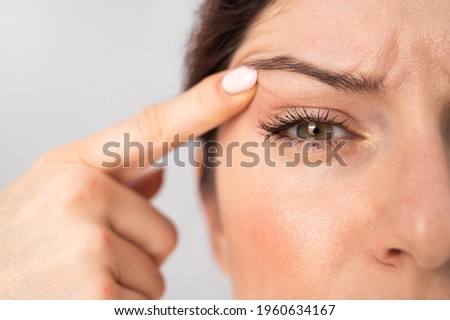 Close-up portrait of Caucasian middle-aged woman pointing to the wrinkles on the upper eyelid. Signs of aging on the face Royalty-Free Stock Photo #1960634167