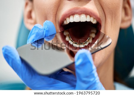 Close-up of orthodontist checking lingual braces of female patient with a mirror during appointment at dentist's office. Royalty-Free Stock Photo #1963795720