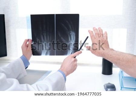 Young doctor examining x-ray of hands of a senior patient with arthritis. Radiography of a hand. Royalty-Free Stock Photo #1964777035