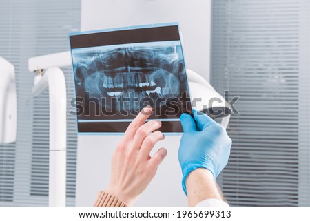 The doctor shows a x-ray picture to patient. Closeup. Doctor hands in gloves hold x-ray picture of patient's jaw