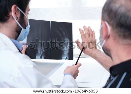Young doctor examining x-ray of hands of a senior patient with arthritis. Radiography of a hand. Royalty-Free Stock Photo #1966496053