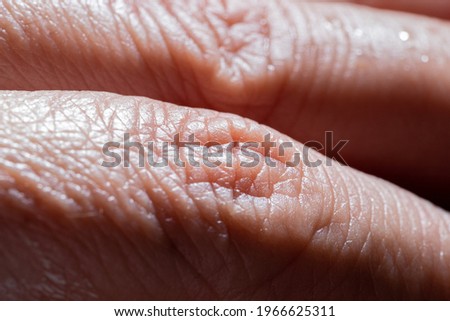 Photo showing super detailed woman skin texture. Fingers macro photography. High-resolution image.