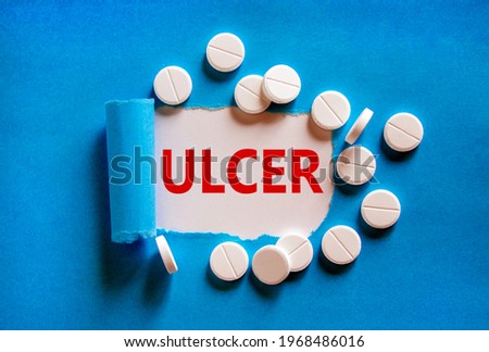 Stomach ulcer symbol. The word 'ulcer' appearing behind torn blue paper, white pills. Medical and stomach ulcer concept. Copy space.