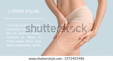 Young woman with cellulite on grey background with space for text Royalty-Free Stock Photo #1972401986