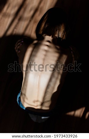 A girl with anorexia turned back, spine and ribs visible. Young woman with anorexia sitting alone and feeling unhappy. Anorexia problem concept. Royalty-Free Stock Photo #1973433926