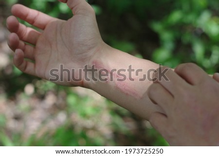A woman scratching very itchy poison ivy while hiking in the woods Royalty-Free Stock Photo #1973725250