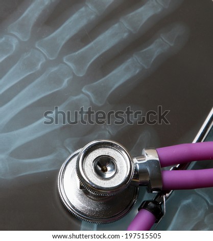 medical stethoscope on an x-ray picture, closeup