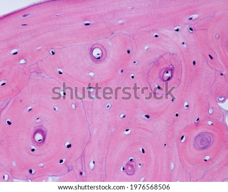 Compact cortical zone of a small bone. The round structures are osteons or Haversian systems, separated by interstitial lamellae. Parallel circumferential lamellae can be seen in the top left corner. Royalty-Free Stock Photo #1976568506