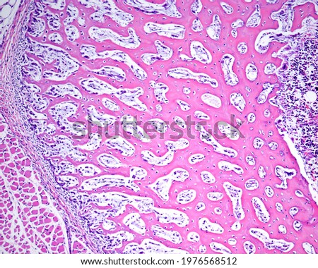 Intramembranous ossification. Cross-sectioned immature bone (diaphysis). The periosteum surrounds the cortical of primary woven bone formed by a network of bone trabeculae. At right, the bone marrow Royalty-Free Stock Photo #1976568512