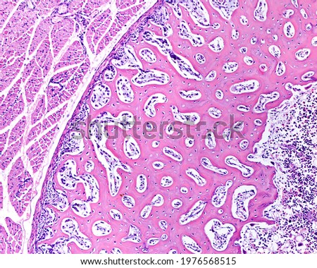 Intramembranous ossification. Cross-sectioned immature bone (diaphysis). The periosteum surrounds the cortical of primary woven bone formed by a network of bone trabeculae. At right, the bone marrow Royalty-Free Stock Photo #1976568515