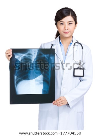 Female doctor hold chest X-ray
