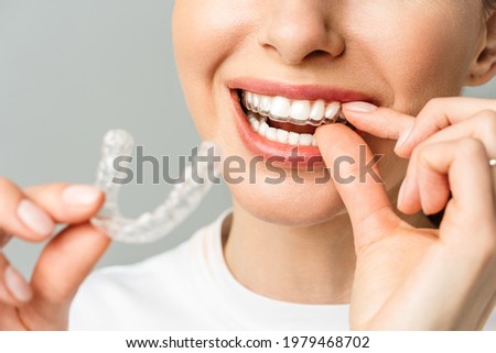 A young woman does a home teeth whitening procedure. Whitening tray with gel Royalty-Free Stock Photo #1979468702