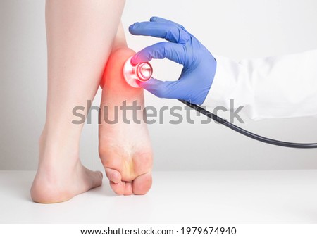 The doctor's hand in a medical glove holds a stethoscope near the sore heel of a female patient. Heel spur and gout diseases concept, osteomyelitis Royalty-Free Stock Photo #1979674940