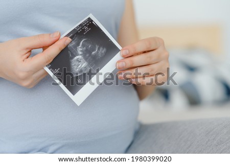 pregnant woman holding ultrasound scan on her belly