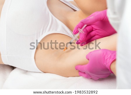 The doctor makes injections of botulinum toxin in the underarm area against hyperhidrosis. Women's cosmetology concept. Royalty-Free Stock Photo #1983532892