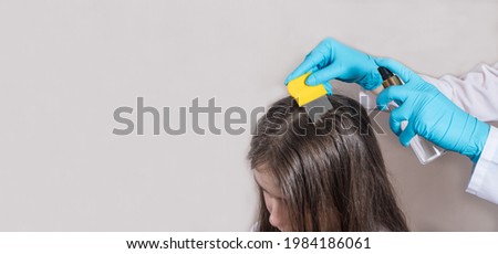 A dermatologist or trichologist applies a dandruff or lice weed to the patient's hair. Treating psoriasis, hair loss, dermatitis or head lice. Banner place for text.