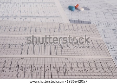 colored pills on electrocardiograms with cardiac arrhythmias. heart medications. post covid arrhythmias concept