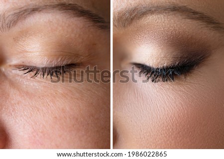 Woman Face Skin Make Up. Comparing Before And After