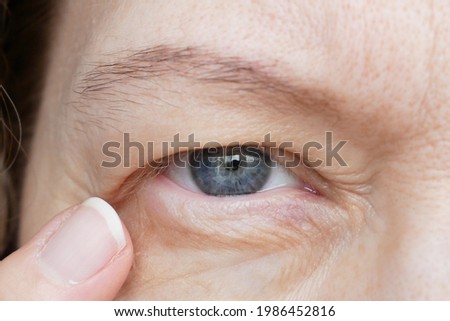 middle-aged woman does corrective eye makeup to correct the drooping eyelid. Ptosis is a drooping of the upper eyelid, lazy eye. Cosmetology and facial concept, closeup Royalty-Free Stock Photo #1986452816