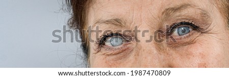 old woman  sick eye detail close-up Royalty-Free Stock Photo #1987470809