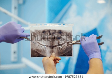 Dentists holding stainless steel dental instruments near X-ray picture of an unrecognizable patient in dental clinic