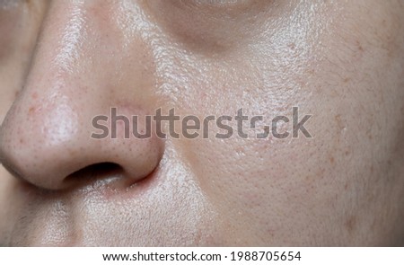 Oily skin with wide pores in face of Southeast Asian, Myanmar or Korean adult young man. Closeup view. Royalty-Free Stock Photo #1988705654