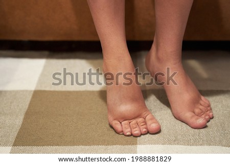 Woman with swelling on the legs, tired and pain in the legs, swelling during pregnancy. High quality photo Royalty-Free Stock Photo #1988881829