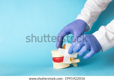 Doctor's hands glue a medical plaster on the mockup of the intervertebral disc, blue background. Spine Disease Therapy Concept vertebroplasty and epidural infiltration. Copy space for text Royalty-Free Stock Photo #1991422016