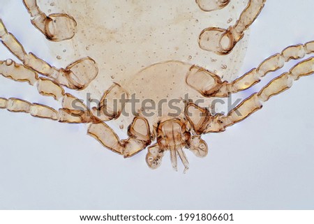 Dust Mite under the light microscope view.  Royalty-Free Stock Photo #1991806601