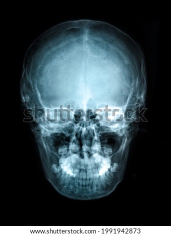 Human skull X-ray image view image isolated on black