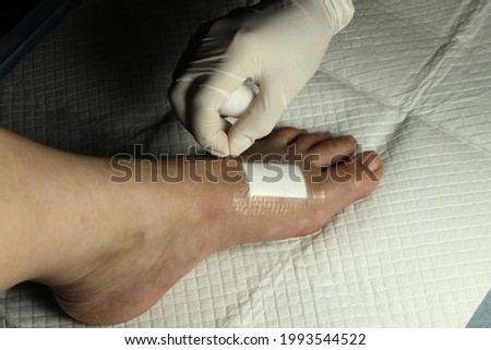 Local medical staff changed of bandage dressing cover the wound at the foot in the dark room. Royalty-Free Stock Photo #1993544522
