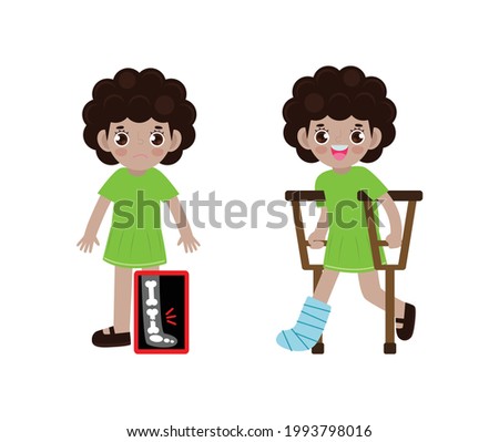 Cute cartoon African-american children with broken leg on x-ray and recovering with cast and crutches, Bone fracture treatment for kids isolated on white background Vector illustration