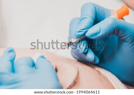 Miliums on the face, removal of hardened and mature milia by a beautician. new Royalty-Free Stock Photo #1994064611