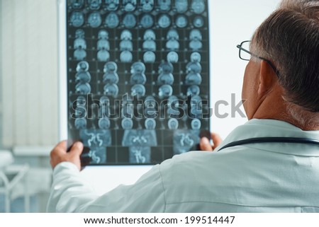 Unrecognizable senior man doctor examines MRI image of human head in hospital