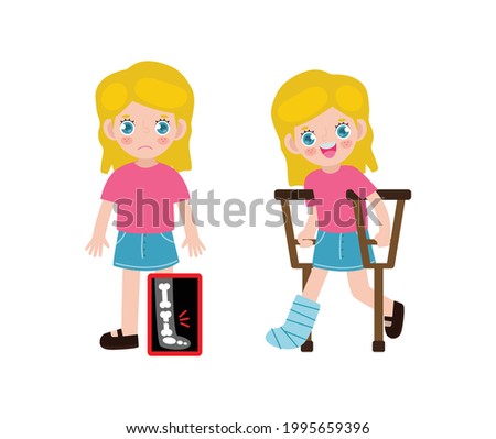 Cute cartoon Caucasian children with broken leg on x-ray and recovering with cast and crutches. Bone fracture treatment for kids. isolated on white background Vector illustration