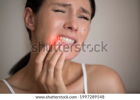 Young woman suffering from herpes on lips. Treatment of herpes infection and virus
 Royalty-Free Stock Photo #1997289548