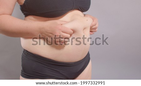 A woman touches her stomach with her hands, stretching the skin from adipose tissue. Body positivity, self-esteem enhancement. Weight loss motivation.