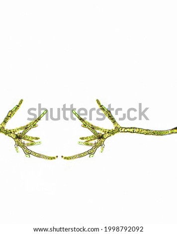Cladophora sp. algae under microscopic view, Green algae