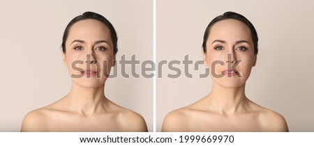 Photo before and after retouch, collage. Portrait of beautiful mature woman on beige background, banner design Royalty-Free Stock Photo #1999669970