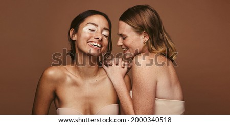 Two young women with skin condition standing together on brown background. Woman with diverse skin accepting their natural beauty. Royalty-Free Stock Photo #2000340518