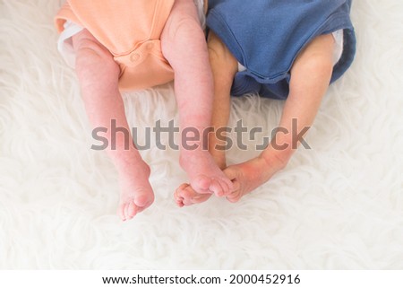 Small legs of newborn premature twins and one of baby have neonatal jaundice. Royalty-Free Stock Photo #2000452916