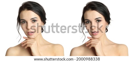 Photo before and after retouch, collage. Portrait of beautiful young woman on white background, banner design