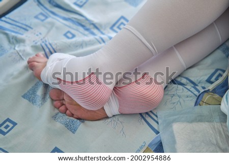 Legs of a pregnant woman in compression stockings on the bed at the time of childbirth
