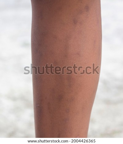 
close-up photo of legs on a black background.