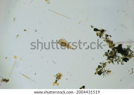 Ciliates Stentor found in freshwater pond under the light microscope