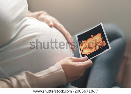 Asian pregnant woman holding ultrasound 4d scan image, Expectation of a child and Maternity prenatal care and woman pregnancy concept. Royalty-Free Stock Photo #2005671869