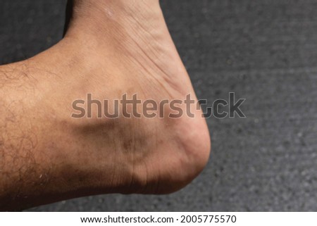 defocused abstract background of close-up photo of the toes on a black background.