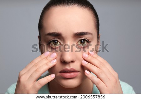 Woman checking her health condition on grey background. Yellow eyes as symptom of problems with liver Royalty-Free Stock Photo #2006557856