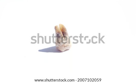 plaque-covered molars isolated on white background.dental plaque